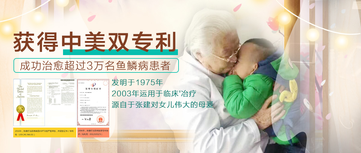 魚鱗病癥狀